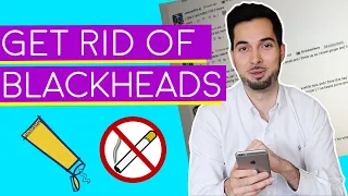 Blackheads | How To Get Rid Of Blackheads