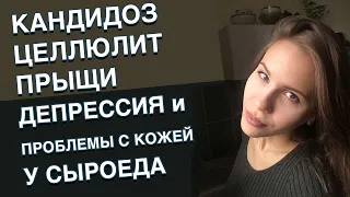 КАНДИДОЗ, ЦЕЛЛЮЛИТ, ПРЫЩИ, ДЕПРЕССИЯ И ПРОБЛЕМЫ С КОЖЕЙ НА СЫРОЕДЕНИИ. Экс-веган история Гульназ