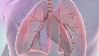 Symptoms of lung cancer
