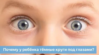 Почему у ребёнка тёмные круги под глазами?