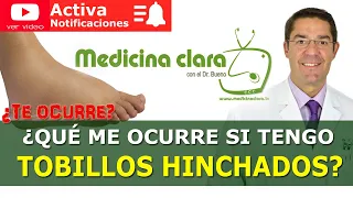 TOBILLOS HINCHADOS. Dolor en los Tobillos. Causas y soluciones | Medicina Clara