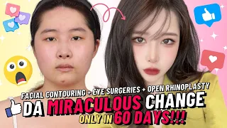 [Plastic Surgery Korea] My amazing Full Face Makeover experiences at DA Plastic Surgery Korea