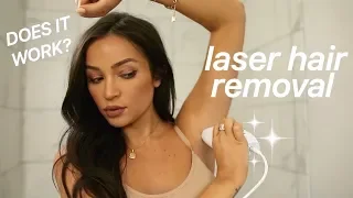 AT HOME LASER HAIR REMOVAL: MY EXPERIENCE! 🤔 FAQ + DEMO