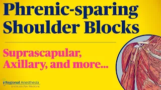 Phrenic-sparing Shoulder Blocks: Suprascapular and Axillary Nerve Blocks