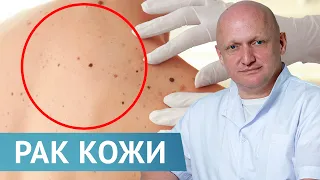 Как победить и вылечить рак кожи? Дерматоонкология в клинике GENESIS Dnepr.