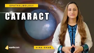 Cataract | Maturity of Cataract | Ophthalmology Video Lectures | V-Learning