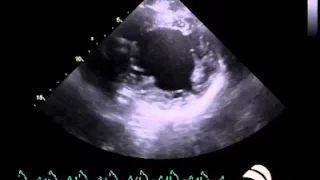 SonoSim Ultrasound Video Challenge - Cardiology