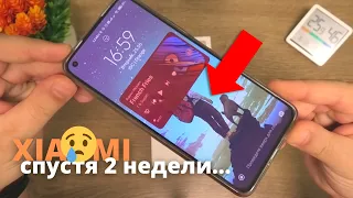 ОБЗОР Xiaomi Mi 11 Lite СПУСТЯ 2 НЕДЕЛИ ► ВСЕ ПЛОХО? ЭКРАН, БАТАРЕЯ, КАМЕРЫ...