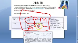 PSM 185 Previous OLD treatment regimen for XDR TB Extended drug resistant Tuberculosis treatment