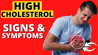 16 Signs And Symptoms Of High Cholesterol You Must Not Ignore