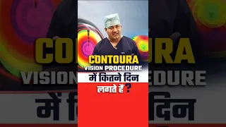 चश्मा हटाने की Contoura लेज़र में कितने दिन लगते हैं?