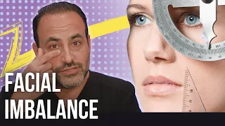 Facial Imbalance | Lesson of the Day