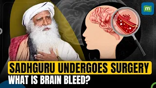 Sadhguru Undergoes Brain Surgery For Chronic Brain Bleed | What Is Brain Stroke?