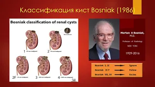 УЗ-диагностика кист почек за 7 минут. УЗИ в урологии-2020 (минисерии) Станислав Феданов