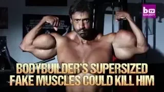 Bodybuilder’s Supersized Fake Muscles Could Kill Him HOOKED ON THE LOOK