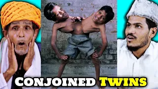 Villagers React To UNUSUAL Conjoined Twins You Won't Believe Exist ! Tribal People React To Twins