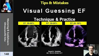 Visual Guessing Ejection Fraction- Technique & practice