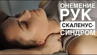 Онемение рук - скаленус синдром