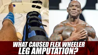 What Caused Flex Wheeler Leg Amputation?