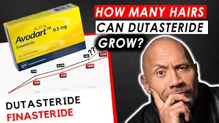How many Hairs can Dutasteride actually Regrow?