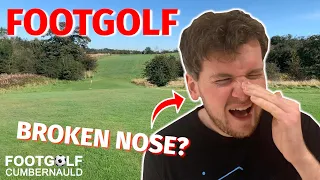 BROKEN NOSE PLAYING FOOTGOLF?! Footgolf | Cumbernauld Footgolf Course