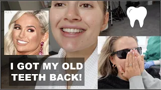 MY TEETH TRANSFORMATION... STRIPPING IT BACK! VLOG | MOLLYMAE