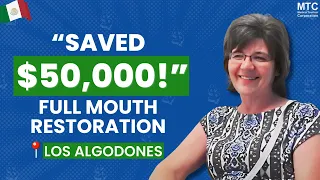 Full Mouth Implants in Los Algodones – Mexico – Client’s Review