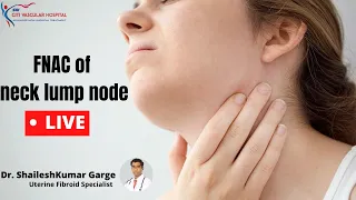 Live FNAC test | How FNAC test is done | FNAC of neck lymph node