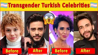 The Incredible Life story of Transgender Turkish Celebs😱Turkish Drama|Turkish Series|Turkish Actor