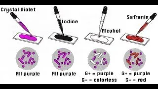 Gram Staining - Amrita University