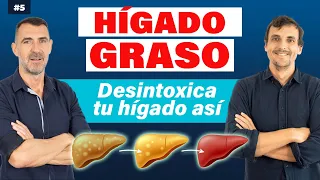 🔴 HÍGADO GRASO 👉 DESINTOXICA tu HÍGADO ASÍ