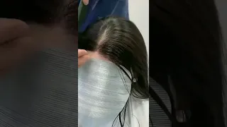 Receding hairline?  Don't miss this! 🔥 Shop in description | Receding hairline patches