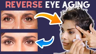 Dont Let EYE WRINKLES age you: Try Age Defying FACE YOGA and NATURAL REMEDIES