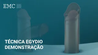 Técnica de Egydio | Demonstração da Cirurgia de Reconstrução Peniana