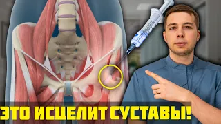 5 ЛУЧШИХ способов вылечить суставы БЕЗ ОПЕРАЦИИ! Это ТОЧНО тебе поможет!