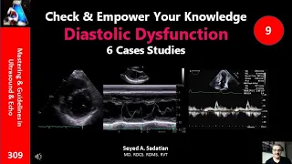 Check & Empower Your Knowldge 9: Diastolic Dysfunction - 6 case studies