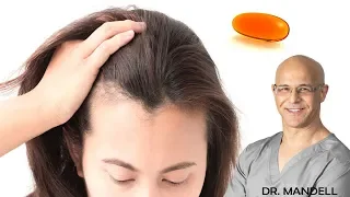 LOSING YOUR HAIR...THIS VITAMIN CAN BE YOUR SAVIOR - Dr Alan Mandell, DC