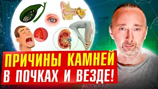 Отчего образуются камни и кальций в Почках? Как очистить Почки и Сосуды?