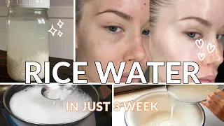 Unlock the Secret: Transform Your Skin with Rice Water 🌾💧