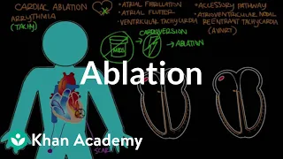 Ablation | Circulatory System and Disease | NCLEX-RN | Khan Academy