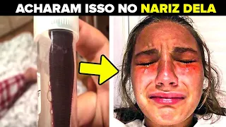 Menina Com Coceira Intensa Dentro do Nariz Visita os Médicos e Descobre Algo Horrível