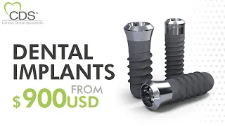 Dental Implants Mexico: How Long Does It Take The Procedure? | Cancun Dental Specialists