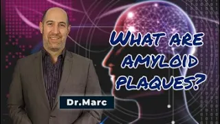 What are Amyloid Plaques? | Dr. Marc