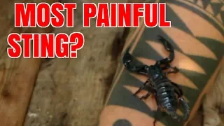 Giant Scorpion Sting - Asian Black Forest Scorpion