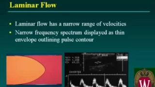 Carotid Sonography Doppler Evaluation and Waveform Analysis