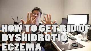 How to Get Rid of Dyshidrotic Eczema