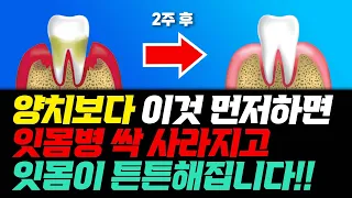 양치보다 이것 먼저하면 잇몸병 싹 사라지고 잇몸이 튼튼해집니다!!