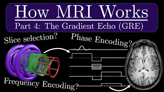 How MRI Works - Part 4 - The Gradient Recalled Echo (GRE)