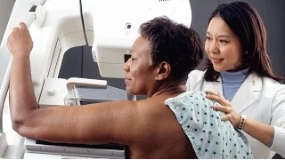Breast imaging expert recommends annual mammograms