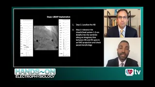 Hands-On Electrophysiology: Left Bundle Branch Pacing